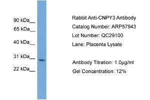 WB Suggested Anti-CNPY3  Antibody Titration: 0. (TNRC5 antibody  (Middle Region))