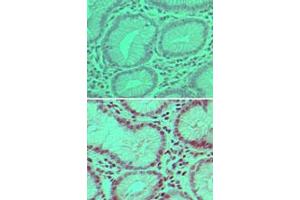 Image no. 1 for anti-Ubiquitin Specific Peptidase 7 (Herpes Virus-Associated) (USP7) (AA 30-80) antibody (ABIN960400) (USP7 antibody  (AA 30-80))