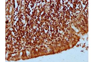 IHC image of ABIN7157277 diluted at 1:300 and staining in paraffin-embedded human lung tissue performed on a Leica BondTM system. (KLHL2 antibody  (AA 1-200))