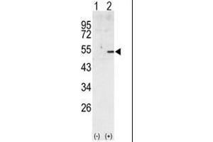 Western blot analysis of CCNA2 (arrow) using rabbit polyclonal CCNA2 Antibody