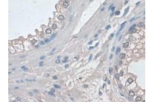 Immunohistochemistry (IHC) image for anti-Mitogen-Activated Protein Kinase 3 (MAPK3) (AA 75-312) antibody (ABIN7433528)