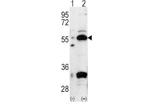 Western Blotting (WB) image for anti-Pancreatic and Duodenal Homeobox 1 (PDX1) antibody (ABIN3001418) (PDX1 antibody)