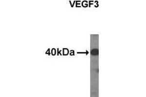 Western analysis of extracts from HDMEC cells using VEGF3 antibody. (VEGFC antibody  (C-Term, N-Term))