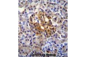 Immunohistochemistry (IHC) image for anti-Nucleotide-Binding Oligomerization Domain Containing 1 (NOD1) antibody (ABIN2996386) (NOD1 antibody)