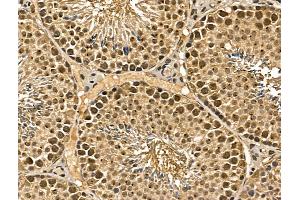 ABIN7094357 and ABIN7098404 at 1/100 staining Mouse testis tissue by IHC-P. (MGAT4C antibody  (Internal Region))