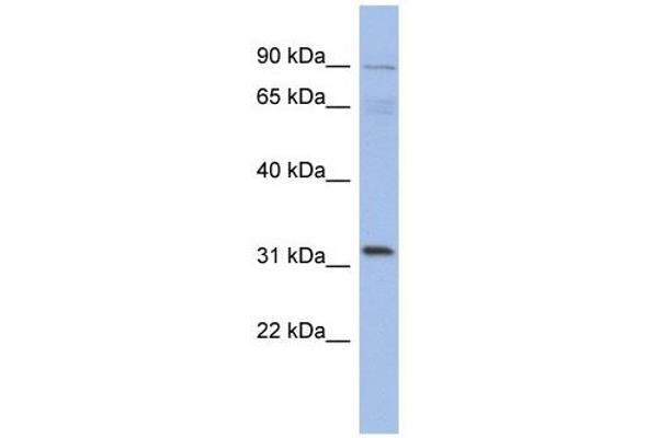 TBC1D14 antibody  (N-Term)