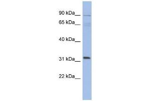 TBC1D14 antibody used at 1 ug/ml to detect target protein.