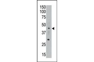 Image no. 1 for anti-Apolipoprotein B mRNA Editing Enzyme, Catalytic Polypeptide-Like 3G (APOBEC3G) (Middle Region) antibody (ABIN356858)