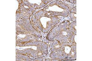 IHC analysis of BBS9 using anti-BBS9 antibody (ABIN7601518). (BBS9 antibody  (AA 37-793))