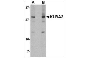 Western blot analysis of KLRA2 in mouse spleen tissue lysate with this product at (A) 0. (Klra2 antibody  (C-Term))