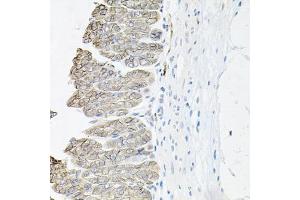 Immunohistochemistry of paraffin-embedded mouse stomach using ATP1B1 antibody (ABIN5973412) at dilution of 1/100 (40x lens). (ATP1B1 antibody)