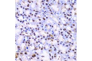 Immunohistochemistry of paraffin-embedded rat pancreas using XRCC4 Antibody (ABIN5970836) at dilution of 1/200 (40x lens). (XRCC4 antibody)