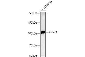 Western blot analysis of extracts of Rat kidney, using Prdm9 antibody (ABIN7269500) at 1:1000 dilution. (PRDM9 antibody)
