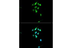 Immunofluorescence analysis of U2OS cells using NR3C1 antibody.