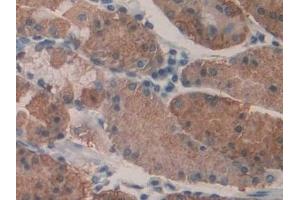 Detection of KARS in Human Stomach Tissue using Polyclonal Antibody to Lysyl tRNA Synthetase (KARS) (KARS antibody  (AA 323-553))