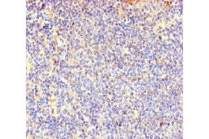 Immunohistochemistry of paraffin-embedded human lymphoid tissue using ABIN7147985 at dilution of 1:100 (COTL1 antibody  (AA 2-142))