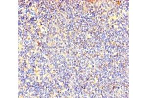 Immunohistochemistry of paraffin-embedded human lymphoid tissue using ABIN7147985 at dilution of 1:100 (COTL1 antibody  (AA 2-142))