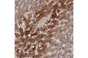 Immunohistochemical staining (Formalin-fixed paraffin-embedded sections) of human liver with CP polyclonal antibody  shows moderate cytoplasmic positivity in hepatocytes at 1:20-1:50 dilution. (Ceruloplasmin antibody)