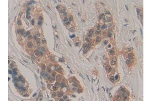 Immunohistochemistry (IHC) image for anti-Hypoxanthine phosphoribosyltransferase 1 (HPRT1) (AA 3-218) antibody (ABIN7432454)