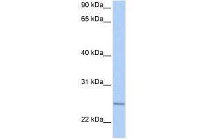 WB Suggested Anti-RABL4 Antibody Titration:  0. (RABL4 antibody  (C-Term))