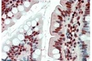 Image no. 2 for anti-Ewing Sarcoma Breakpoint Region 1 (EWSR1) (Internal Region) antibody (ABIN375098)