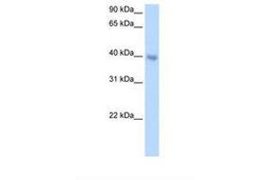 Image no. 2 for anti-Distal-Less Homeobox 5 (DLX5) (AA 120-169) antibody (ABIN6737699) (DLX5 antibody  (AA 120-169))