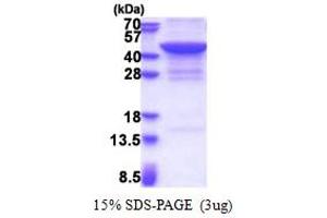 Jumonji Domain Containing 7 (JMJD7) (AA 1-316) protein (His tag)