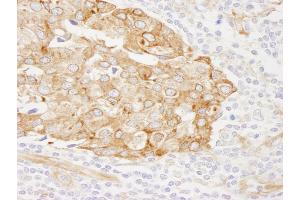 Immunohistochemistry (IHC) image for anti-Reticulocalbin 1, EF-Hand Calcium Binding Domain (RCN1) (AA 1-75) antibody (ABIN7449011)