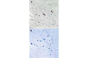 Immunohistochemical staining of human brain tissue by GAB2 (phospho Y643) polyclonal antibody  without blocking peptide (A) or preincubated with blocking peptide (B) under 1:50-1:100 dilution. (GAB2 antibody  (pTyr643))