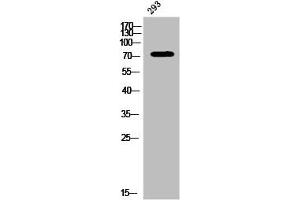 Western Blot analysis of 293 cells using Phospho-PKC α (Y657) Polyclonal Antibody (PKC alpha antibody  (pTyr657))