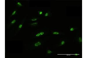 Immunofluorescence of purified MaxPab antibody to FRG1 on HeLa cell. (FRG1 antibody  (AA 1-258))