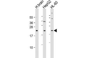 All lanes : Anti-PNOC Antibody (Center) at 1:4000 dilution Lane 1: human brain lysate Lane 2: HepG2 whole cell lysate Lane 3: HL-60 whole cell lysate Lysates/proteins at 20 μg per lane.