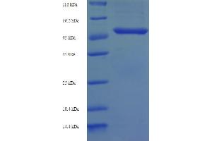 SDS-PAGE (SDS) image for Glutaminyl-Peptide Cyclotransferase (QPCT) (AA 29-361) protein (His-SUMO Tag) (ABIN4976140)