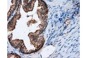 Immunohistochemical staining of paraffin-embedded Kidney tissue using anti-RALBP1 mouse monoclonal antibody. (RALBP1 antibody)