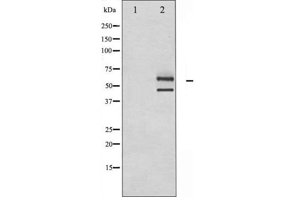 JNK antibody