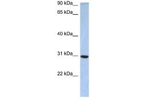 C16ORF65 antibody used at 1 ug/ml to detect target protein. (PDZD9 antibody  (Middle Region))