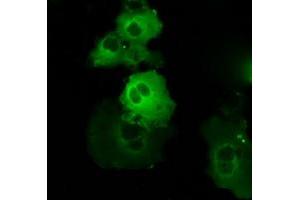 Image no. 9 for anti-Bruton Agammaglobulinemia tyrosine Kinase (BTK) antibody (ABIN1496974) (BTK antibody)