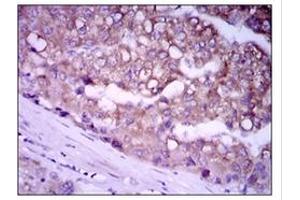 Immunohistochemistry (IHC) image for anti-Glypican 3 (GPC3) antibody (ABIN1107403) (Glypican 3 antibody)