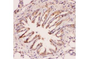 Anti-MyD88 Picoband antibody,  IHC(P): Rat Lung Tissue (MYD88 antibody  (AA 44-264))
