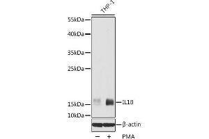 Western blot analysis of extracts of THP-1 cells using IL1 beta Polyclonal Antibody at dilution of 1:1000. (IL-1 beta antibody)