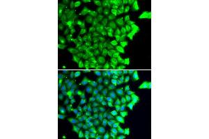 Immunofluorescence analysis of MCF7 cell using TRIAP1 antibody.