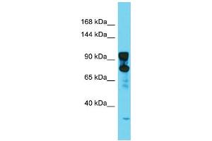 Host: Rabbit  Target Name: Dnm2  Sample Tissue: Rat Testis lysates  Antibody Dilution: 1.