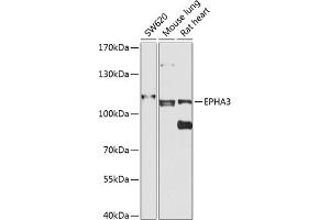 Western blot analysis of extracts of various cell lines, using EPH antibody (ABIN6131627, ABIN6140213, ABIN6140214 and ABIN6224468) at 1:1000 dilution. (EPH Receptor A3 antibody  (AA 400-545))