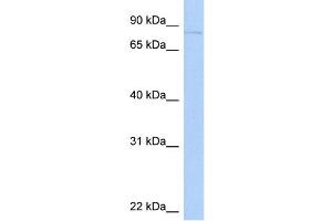WB Suggested Anti-KIF2C Antibody Titration:  0. (KIF2C antibody  (N-Term))