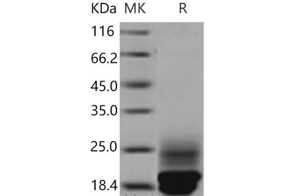 CST3 Protein (His tag)