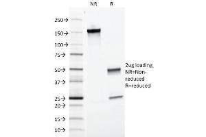 SDS-PAGE (SDS) image for anti-Epithelial Cell Adhesion Molecule (EPCAM) (AA 77-202), (Extracellular Domain) antibody (ABIN6383801)
