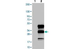 Western blot analysis of Lane 1: Negative control (vector only transfected HEK293T lysate). (C12orf43 antibody)