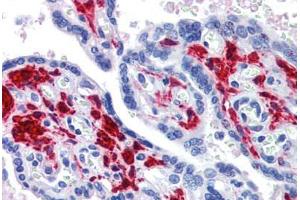Placenta, Human: Formalin-Fixed, Paraffin-Embedded (FFPE) (DDX58 antibody)