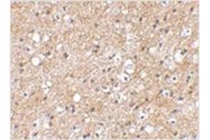 Immunohistochemical staining of human brain tissue using IPR1 antibody at 2. (SP110 antibody  (C-Term))