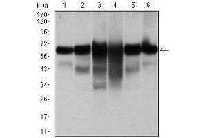 Western blot analysis using CK5 mouse mAb against A431 (1), MCF-7 (2), HeLa (3), HepG2 (4), 3T3-L1 (5), and COS-7 (6) cell lysate.